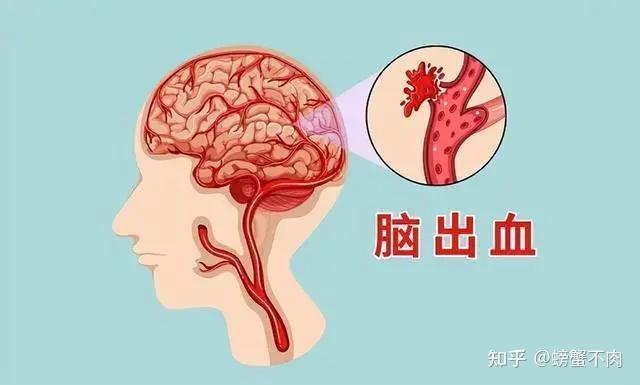 高血压的危害你注意了吗？